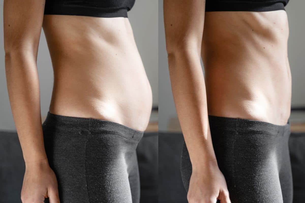 Post-Pregnancy: What Happens to Your Abdominal Muscles After Birth Chipping Norton