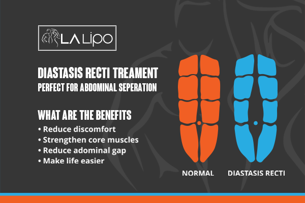 When to Be Concerned About Abdominal Muscle Changes Chipping Norton