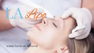 Woman receiving Actinic Keratosis Removal Treatment Chipping Norton