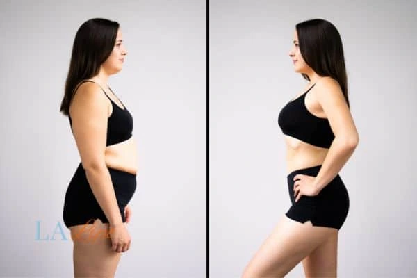 LA-EMS Body Sculpting Chipping Norton results before and after of womans results on body toning.