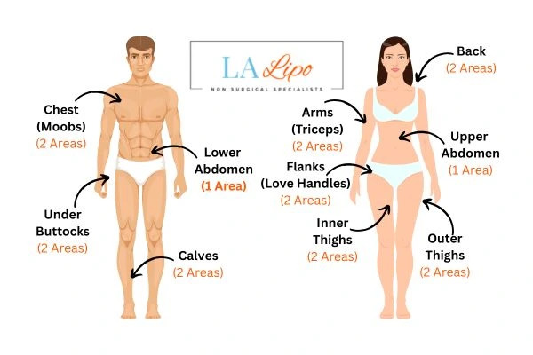 LA LIPO Cryolipolysis Areas Chipping Norton