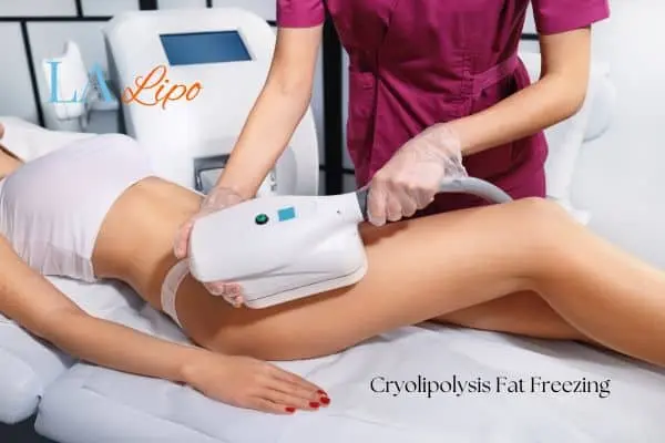 Woman receiving coolsculpting Chipping Norton treatment on her thighs