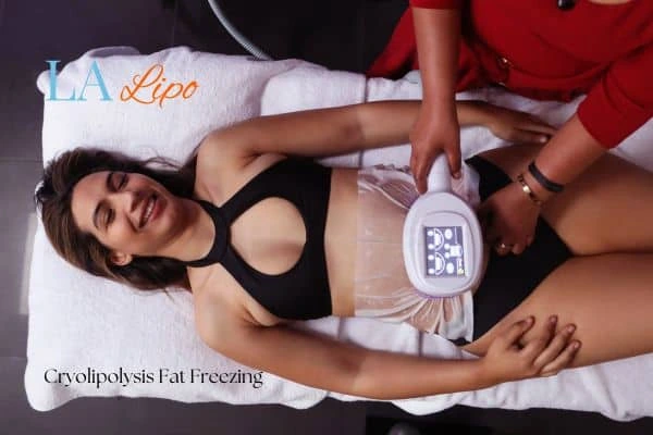 woman getting cryolipolysis Chipping Norton