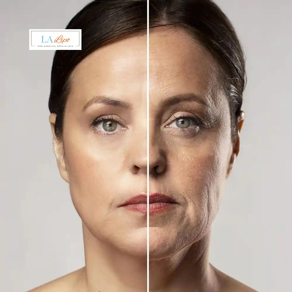 How Can You Tell If Non-Surgical Skin Tightening Is Right for You Chipping Norton?