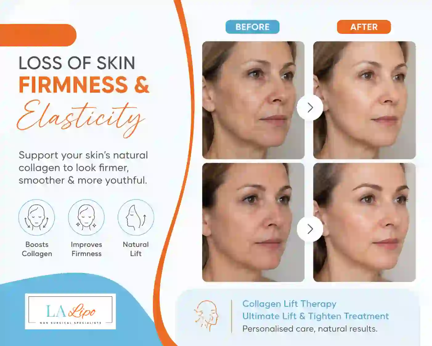 Sign #7: Loss of Skin Firmness and Elasticity Chipping Norton